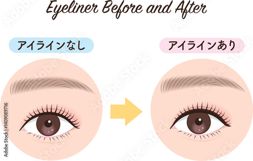 アイライン　ビフォーアフター