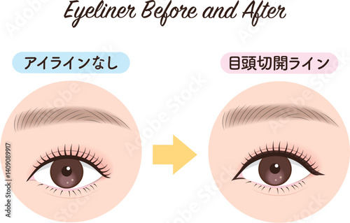 アイライン　ビフォーアフター　目頭切開ライン