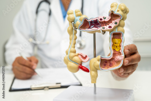 Intestine, appendix and digestive system, doctor holding anatomy model for study diagnosis and treatment in hospital.