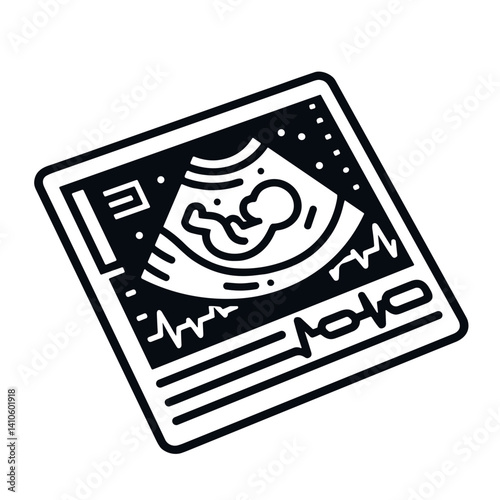 A minimalistic black-and-white line art illustration of an ultrasound photo