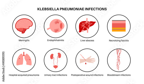 Klebsiella pneumoniae poster