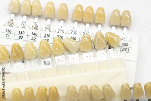 Organized dental shade guides with alphanumeric labels displaying various tooth colors for precise restorations and treatment planning