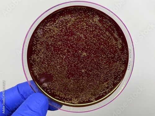 Many small golden colonies of bacteria on red ENDO medium.