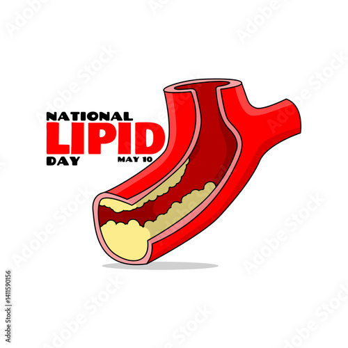 National Lipid Day to celebrate on May 10th. Illustration of blood vessels almost full of fat with bold text on white background. Health event banner.