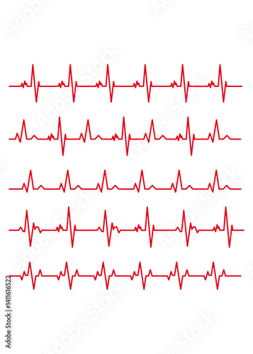 Electrocardiogram Set of materials to illustrate the line rhythm
