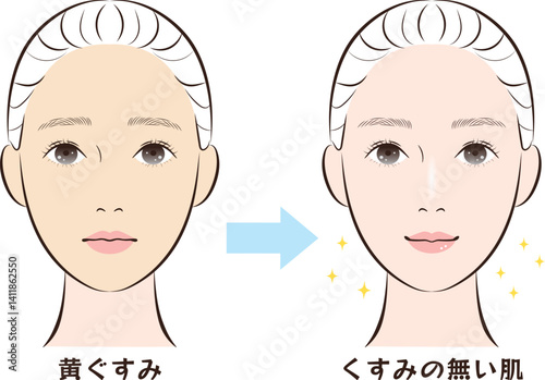 黄ぐすみ肌からくすみの無い肌へのビフォーアフター