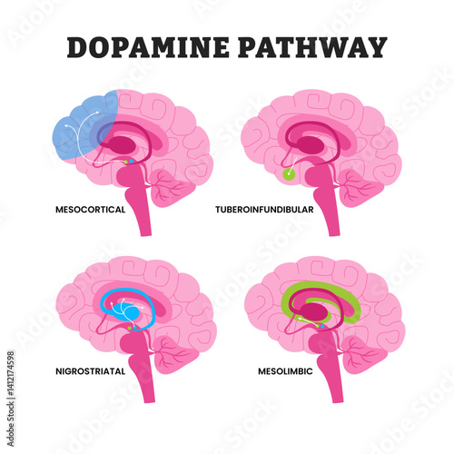 Dopamine Pathway Brain Diagram educational medical poster design healthcare, labeled Mesolimbic, Mesocortical, Nigrostriatal, and Tuberoinfundibular Circuits for Neurotransmitter Function and Brain.