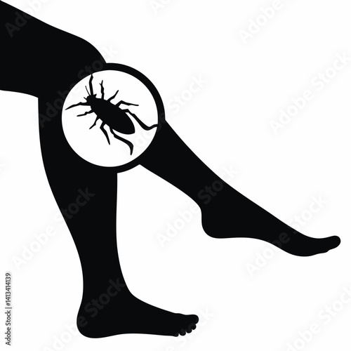 Bug bite on lower leg shown in silhouette icon