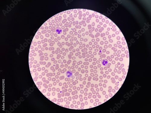 Normal red blood cell.