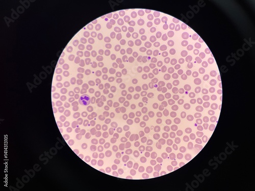 Normal red blood cell.