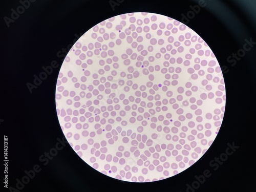 Normal red blood cell.