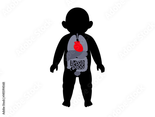 Heart disease in a child