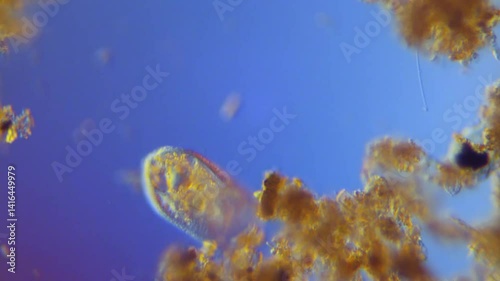 Frontonia sp. among freshwater microorganisms-200x DIC microscope