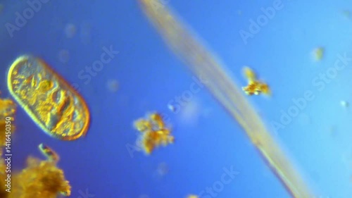 Frontonia-200x DIC Microscope