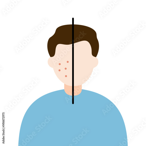 Man face with red rash pimple skin problem. Before and after comparison. Beauty, skincare, treatment, hygiene, allergy concepts. Flat vector character design isolated illustration.