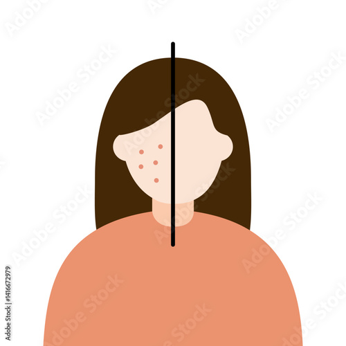 Woman face with red rash pimple skin problem. Before and after comparison. Beauty, skincare, treatment, hygiene, allergy concepts. Flat vector character design isolated illustration.