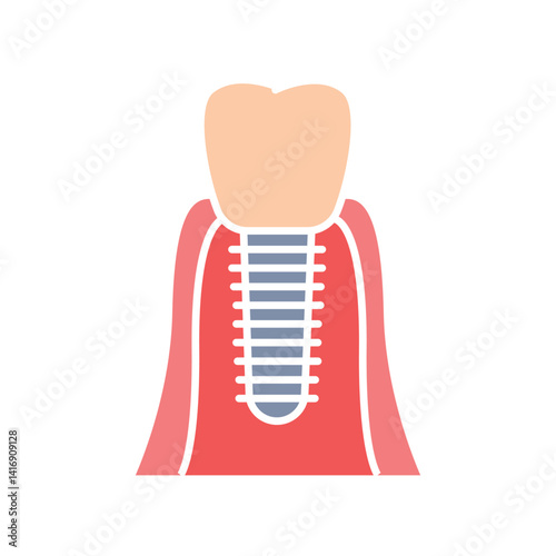 dental implant color flat icon for digital and print projects.