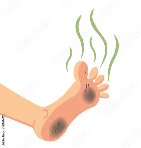 Smelly Feet