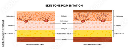 Melanin and melanocytes