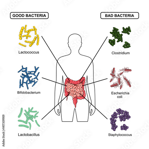Vector illustration of normal and pathogenic human microbiota, bad and good bacteria. Infographic suitable for medical, clinical, educational or science posters.