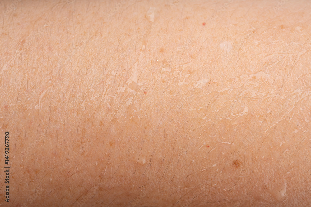 Fototapeta premium Wet human skin with water drops closeup. Sweat healthy body, macro shower drops on woman skin