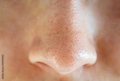 Close-up of a woman's nose with blackheads or black dots.