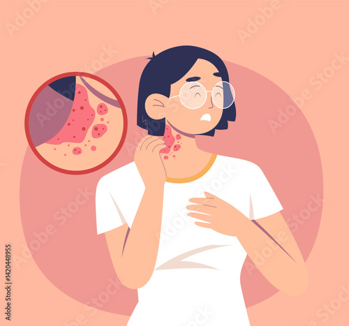Painful Skin Rashes and Spots on Neck - Stock Illustration