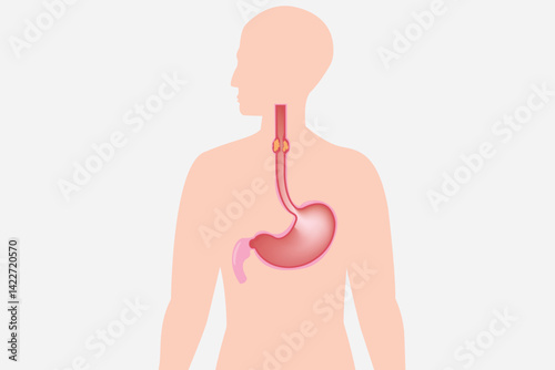 Healthcare infographic depicting esophageal cancer symptoms and anatomy. medical illustration. eps 10