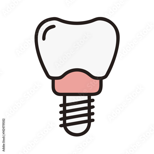 Dental Implant Vector Illustration on a Black Background