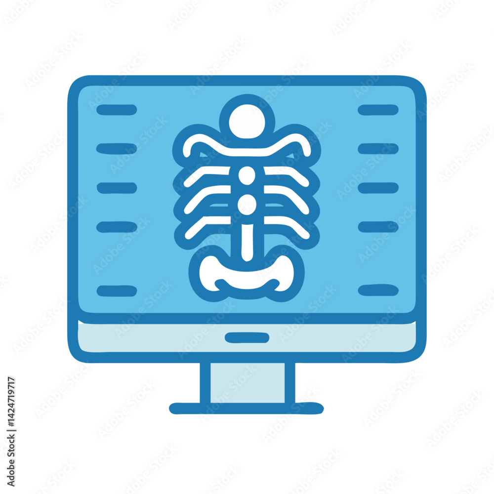 X-ray on Computer Screen, Medical Diagnosis, Health Care X-ray on Computer Screen, Medical Diagnosis, Health Care