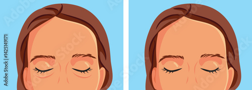 Eye Bag Removal Surgery Before and After Vector Design. Woman turns to plastic surgery for rejuvenation procedure
