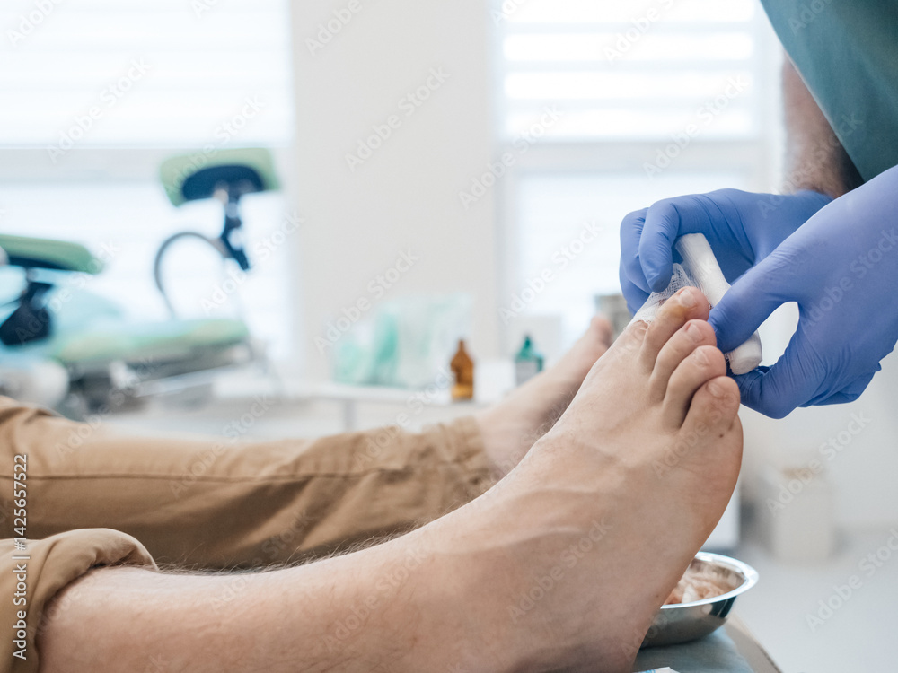 custom made wallpaper toronto digitalResection of the nail plate, removal of ingrown nail. Dressing after surgery on the toe. Surgical treatment of onychocryptosis, paronychia and purulent disease