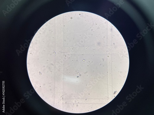 Calcium oxalate crystal in urine sediment.