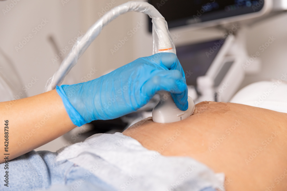 Close up ultrasound scanner device in the hand of a professional doctor examining pregnant woman patient, doing abdominal ultrasound scanning. sonogram, sonography, sonographer, early pregnancy