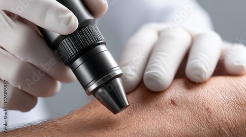 Close-up of dermatologist's hands examining skin lesion with dermatoscope - dermatological professional analysis
