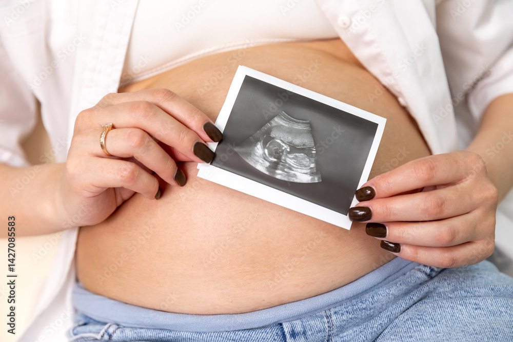 Ultrasound picture pregnant baby photo. Woman holding ultrasound pregnancy sonogram picture of unborn baby inside her big belly. Concept of pregnancy, maternity, expectation for baby birth