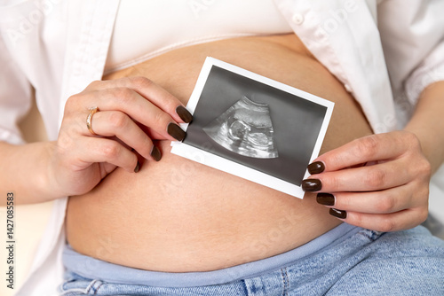 Obraz na płótnie Ultrasound picture pregnant baby photo. Woman holding ultrasound pregnancy sonogram picture of unborn baby inside her big belly. Concept of pregnancy, maternity, expectation for baby birth w salonie