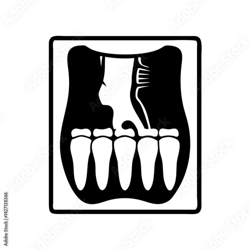 x ray icon, x ray silhouette vector illustration-simple silhouette illustration of x ray,x ray vector