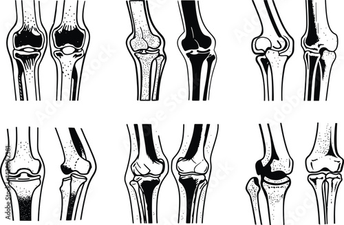 Knee joint anatomy black and white medical illustration set