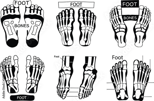 Human foot anatomy illustration showing bones and structure in different views