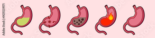 Stomach problems, heartburn, pain, ulcer, acidity, inflammation in the digestive system organ. Vector illustration