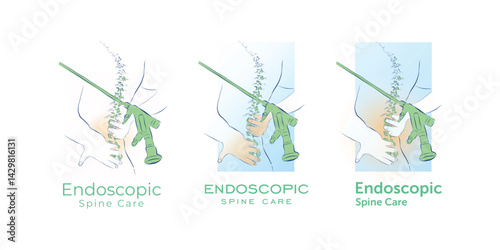 Endoscopic Spine Care Logo Design in Simple Line Art Style – Vector Illustration