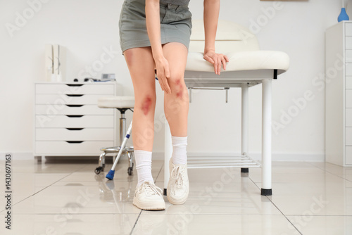 Young woman with bruised le...