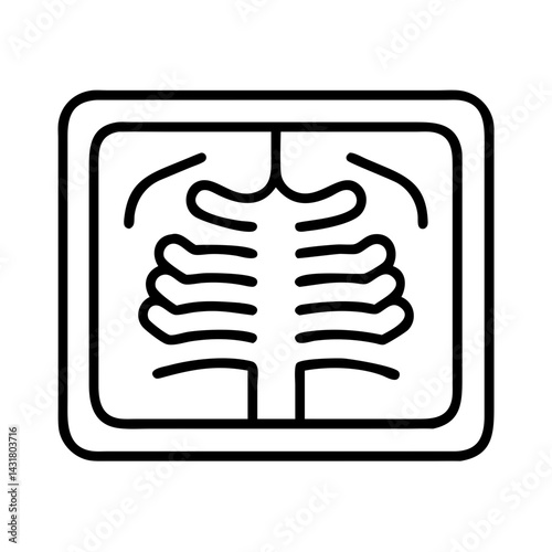 Chest x ray radiology scan diagnostic imaging medical examination healthcare lungs ribs skeleton bone structure