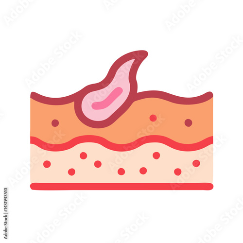 Skin Graft Illustration, Tissue Repair, Healing Wound Concept