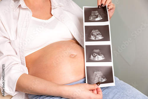 Ultrasound picture, baby photo. Close up pregnant woman holding ultrasound image near her big belly. Concept of pregnancy, maternity, expectation for baby birth