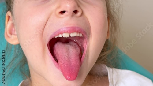 Close-up of little girl opening her mouth wide to the doctor to show her throat. Child is sitting with wide open mouth, with a tongue stuck out, clear view on the uvula and the soft palate