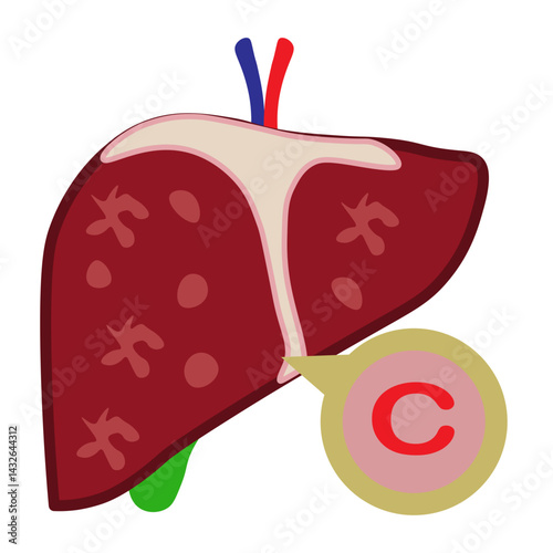 hepatitis c