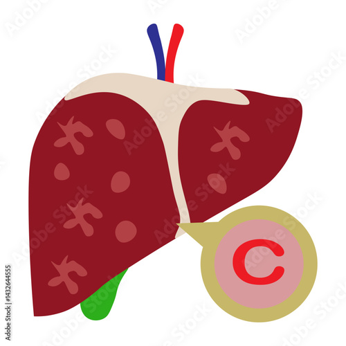 hepatitis c