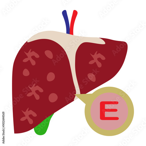 hapatitis e 